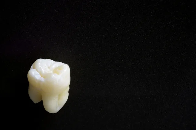 親知らずのCTはすべての人に必要？